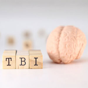 Wooden blocks spell TBI beside a brain model, symbolizing traumatic brain injury on a clean white background.