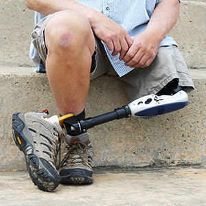 Amputee with legs crossed, detail