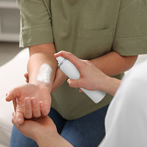A person applying burn spray to a visible burn on another person's arm, illustrating a case involving Severe Burns
